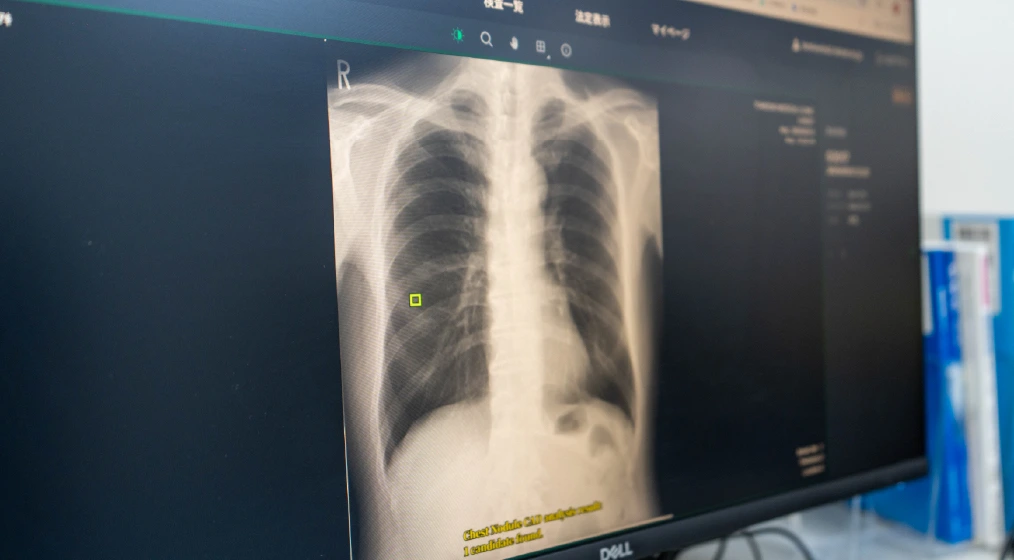 AI技術による精密検査
