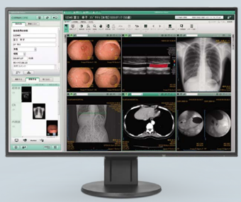 画像診断ワークステーション（富士フイルム社 C@RNACORE™）